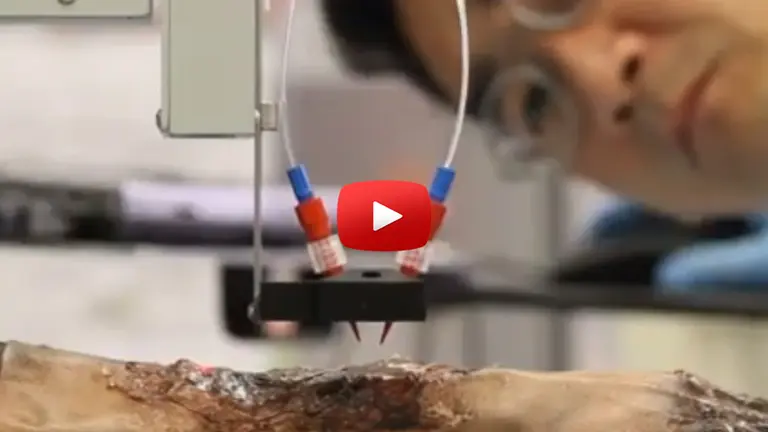 Así es la impresora de piel 3D que imprime directamente sobre la herida