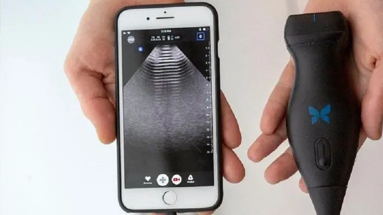 Ecografías desde el smartphone: así es el innovador dispositivo presentado en Argentina