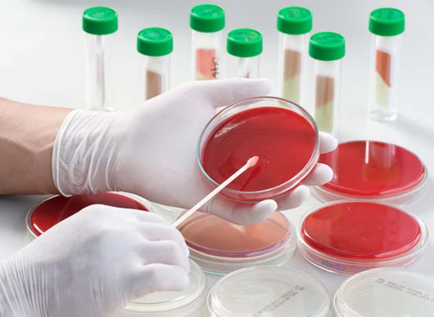 Холера лабораторная. Забор материала для микробиологических исследований. Забор крови для бактериологического исследования. Биологический материал для микробиологического исследования. Микробиологические лабораторные исследования это.