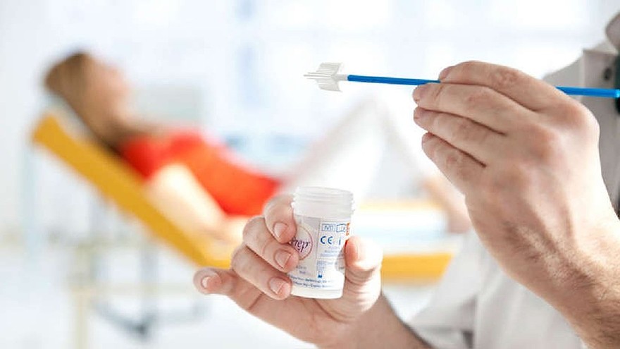 ¿Test de cáncer de cuello uterino en casa? Desarrollaron una prueba que podría tener alta efectividad