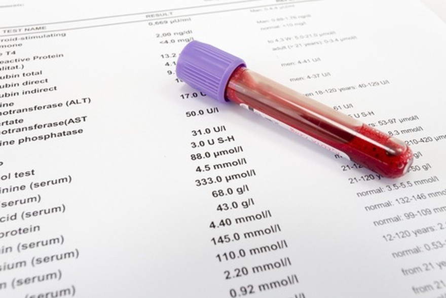 Tips: cómo aumentar los niveles de colesterol "bueno" en el cuerpo