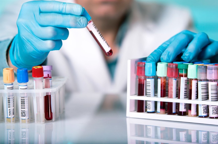 Cuál es el grupo sanguíneo más probable de contraer el coronavirus