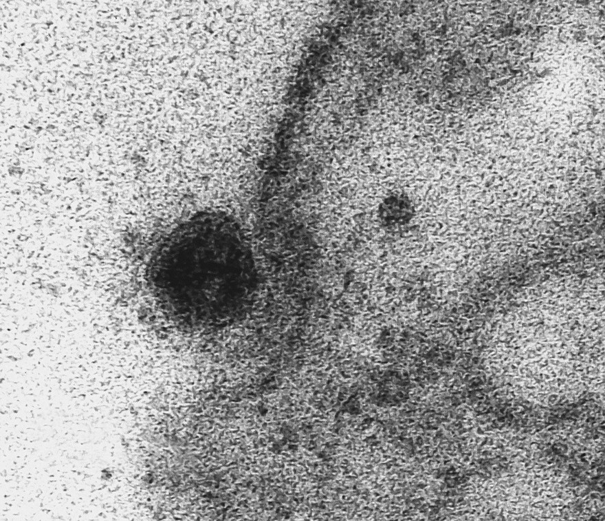 Las primeras imágenes del momento exacto en que el coronavirus infecta una célula