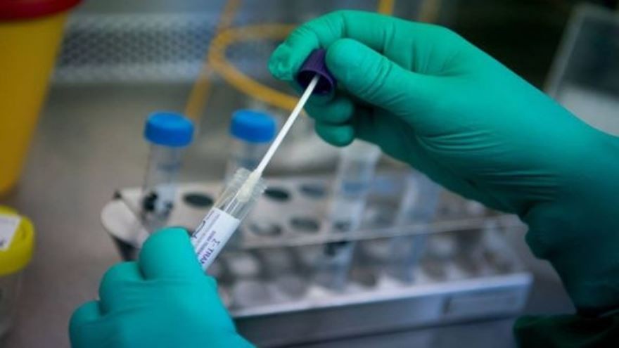 Por qué hubo un aumento tan notorio en los casos nuevos: un experto lo explica