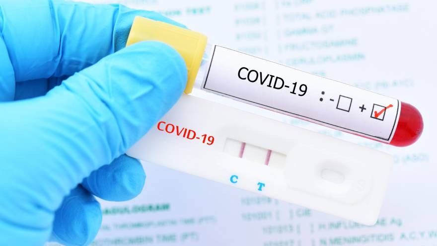 Si el coronavirus circula por el aire: ¿qué nos espera?