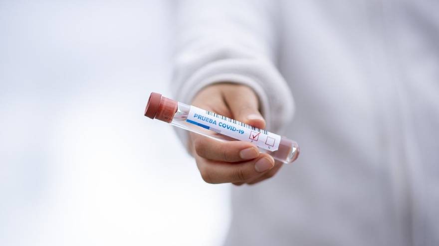 Coronavirus: ¿por qué un sitio internacional sacó de su base a la Argentina y criticó la calidad baja de sus datos sobre testeos?