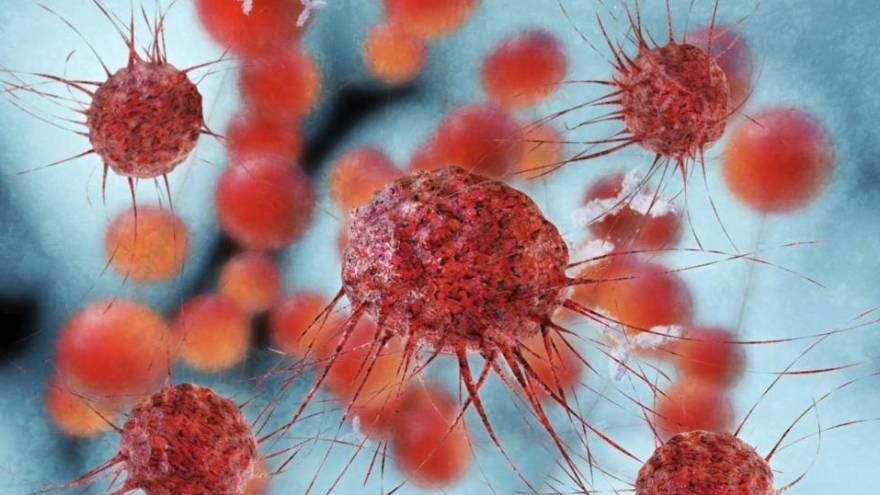 Cómo es el tratamiento experimental contra el cáncer que no utiliza fármacos