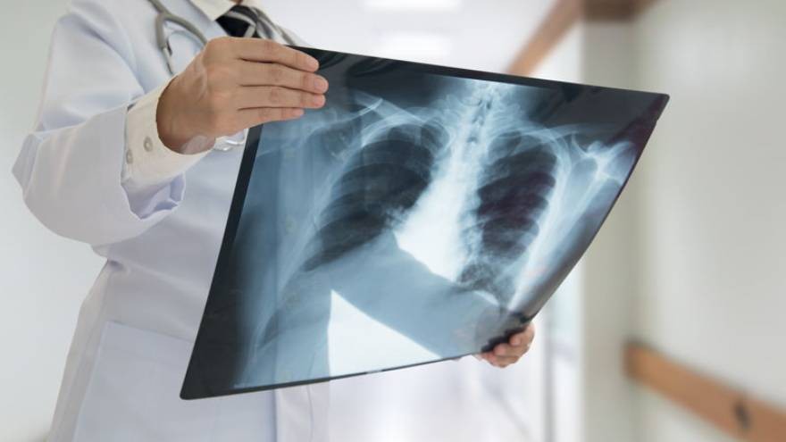 ¿Un nuevo órgano? La ciencia descubrió una parte del cuerpo que hasta ahora se desconocía