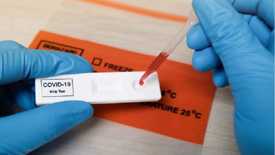 Mientras llega la vacuna, el uso de test rápidos de antígenos es clave para controlar la pandemia y evitar rebrotes