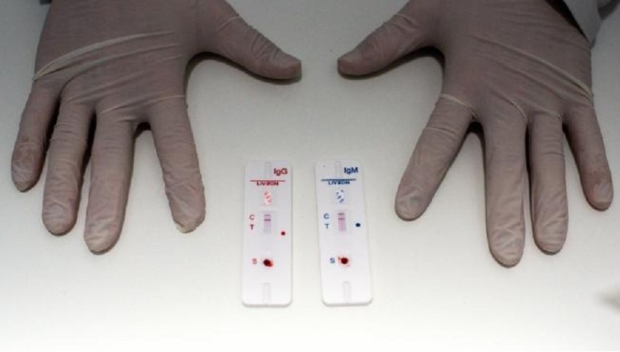 Así es el test de coronavirus "low cost" que ya se comenzó a vender en supermercados