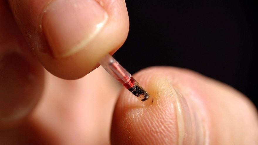 Chips bajo la piel: cómo funciona la tecnología que crece en adopción en todo el mundo