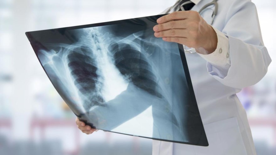 Tecnología argentina contra el coronavirus: empresa diagnostica con radiografías e inteligencia artificial