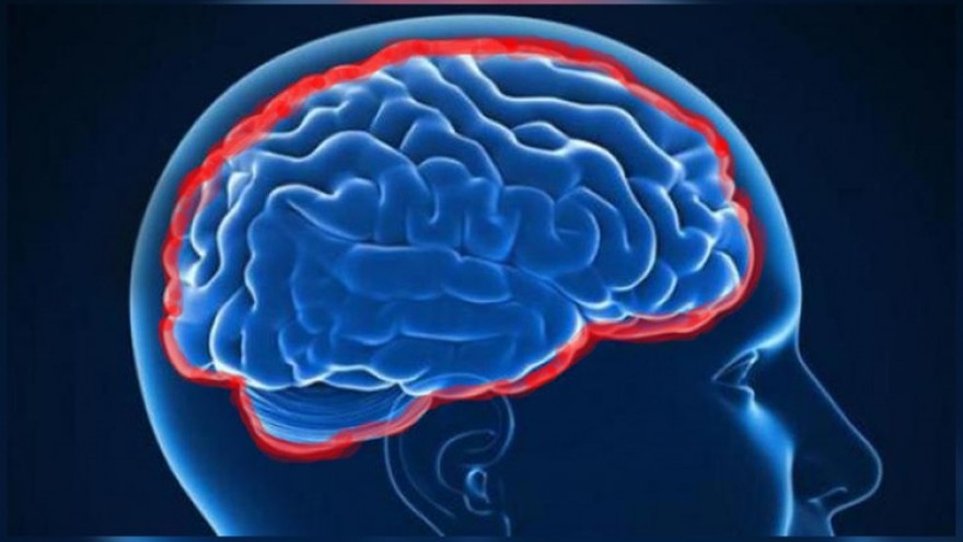 Aumentan los casos de meningitis en el país: ¿qué causa esta enfermedad?