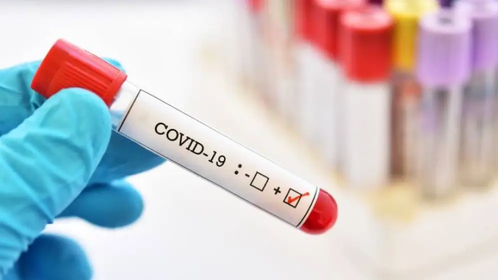 El virus puede atacar de una manera muy agresiva
