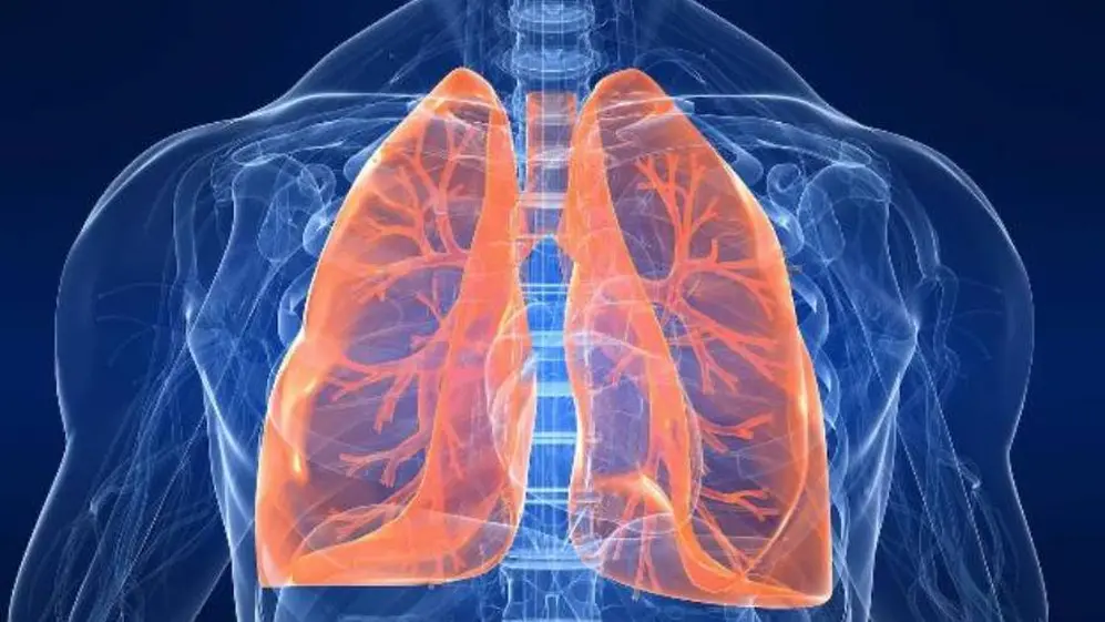 El Covid-19 puede presentar, al igual que otras enfermedades, compromiso pulmonar