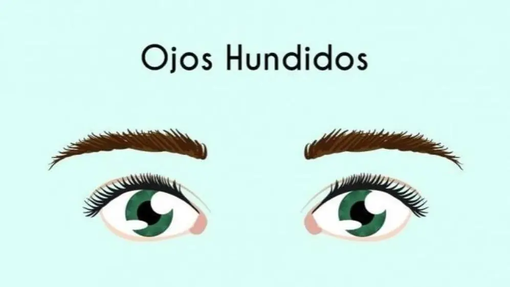 5. Ojos hundidos