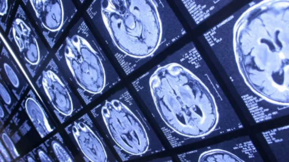 Los expertos estudiaron el ayahuasca y su impacto en las células del cuerpo