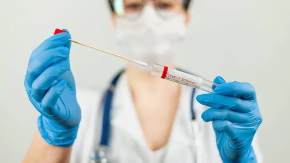 Qué prepagas cubren el test de PCR con y sin síntomas, y cuántas veces al año
