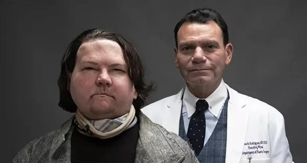 Se trata del primer transplante exitoso de rostro y manos