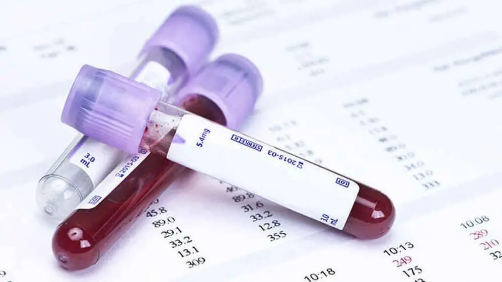 El grupo sanguíneo podría estar relacionado con la infección por Covid-19