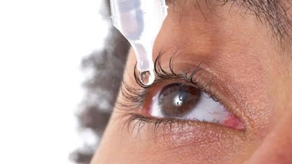 La colocación de gotas en los ojos es uno de los tratamientos para el ojo seco