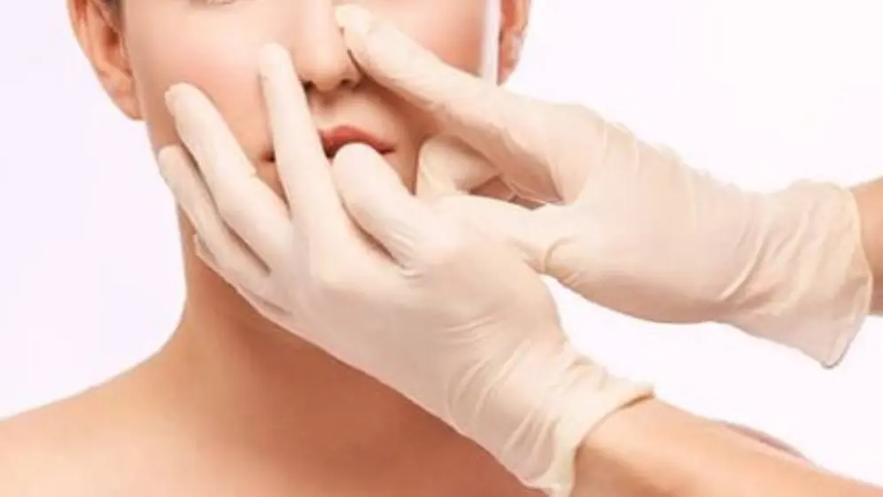 Cuánto cuesta una rinoplastia en Argentina en 2021: la rinoplastia se puede hacer