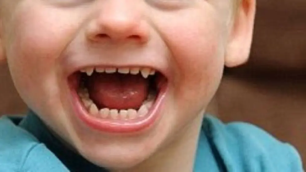 Los niños con este síndrome suelen reír con mucha frecuencia