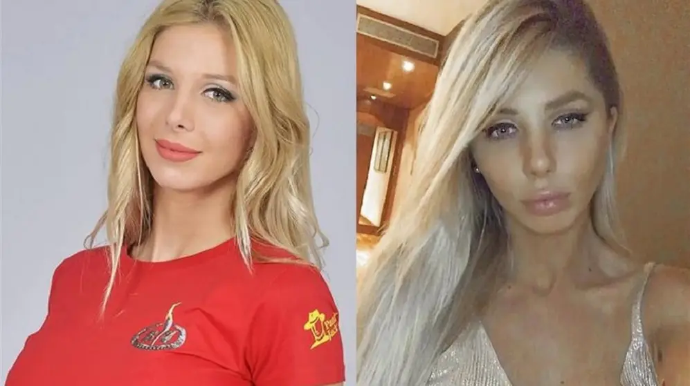 Desde que se hizo conocida gracias a su participación en Gran Hermano 2015 hasta el día de hoy su transformación fue muy grande