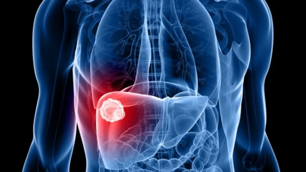 Hay 10 señales que advierten sobre el cuadro de hepatitis.
