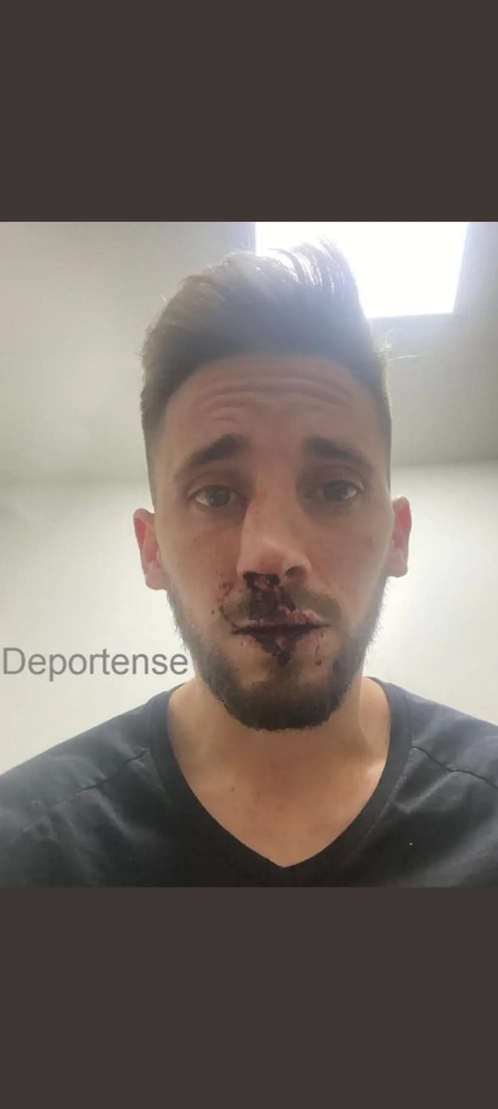 Morgantini muestra las lesiones recibidas tras la agresión