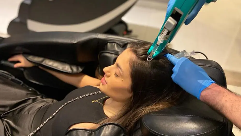 âAdemás del microtrasplante capilar, Hair Recovery cuenta con tratamientos preventivos de la caída 