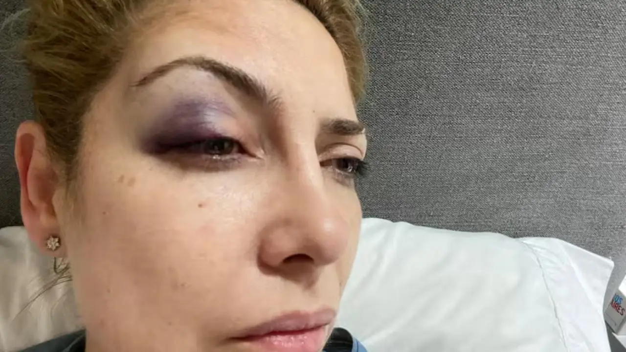 Una de las nuevas fotos que se conocieron de Fabiola Yañez golpeada