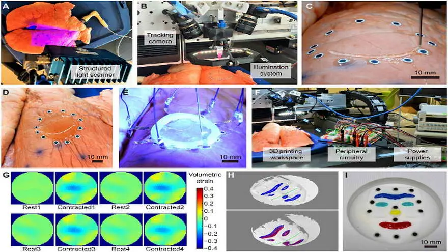 Esta tecnología revolucionaría la forma en que e controlan funciones y parámetros en una cirugía