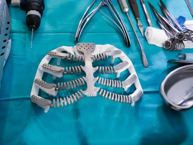 habrá un período de adaptación de su organismo a la prótesis, dentro del cual puede experimentar algunas molestias o dolores, propios a la cirugía realizada y a la colocación de este implante. Pero después de esto se espera que haga su vida normal y de forma segura