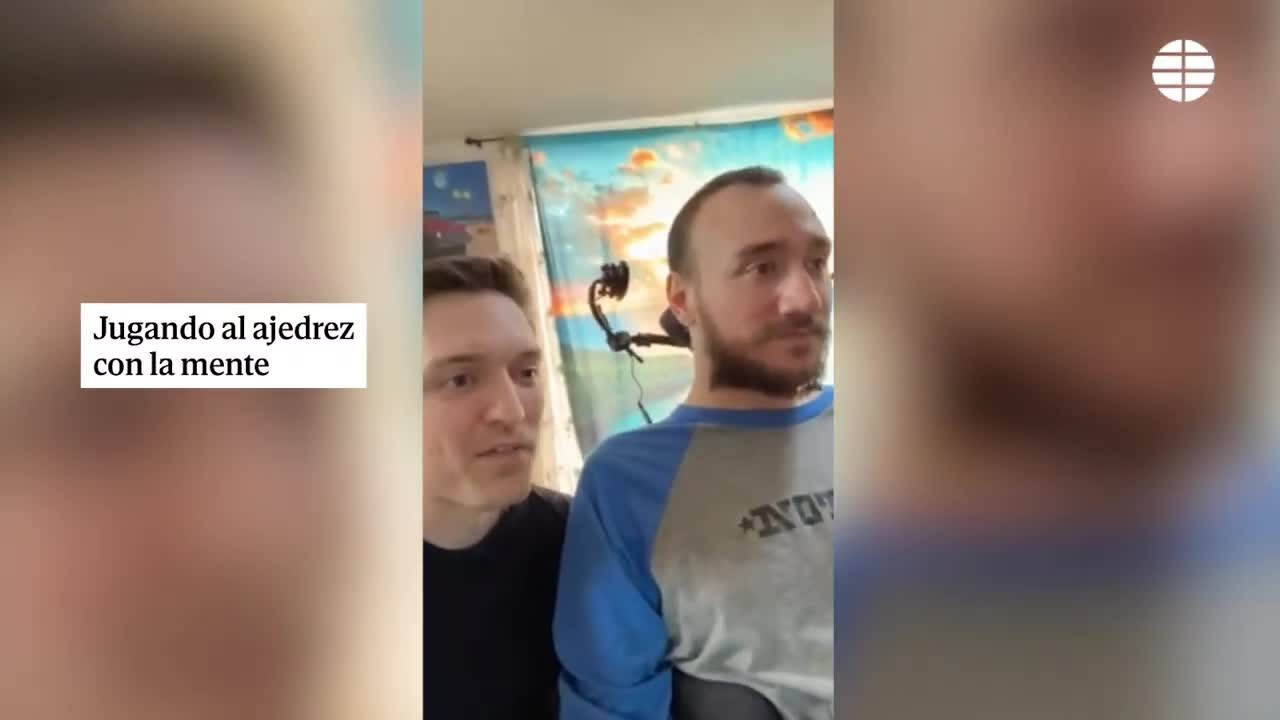 Dolor de cabeza para Elon Musk: el chip implantado en un cerebro tiene fallas